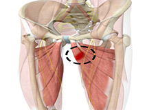 Muscle Injuries