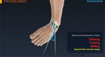 Picture of Ankle Sprain
