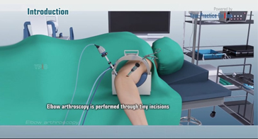 Picture of Elbow Arthroscopy