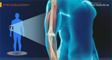 Picture of Elbow Joint Replacement