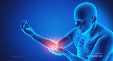 Picture of Elbow Pain