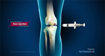 Picture of Intra-articular Knee Injections