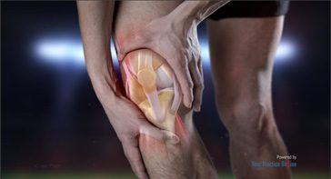 Picture of Knee Pain