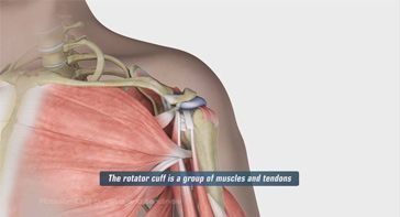 Picture of Rotator Cuff Bursitis