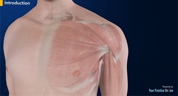 Picture of Rotator Cuff Tear