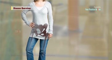 Picture of Slipped Capital Femoral Epiphysis