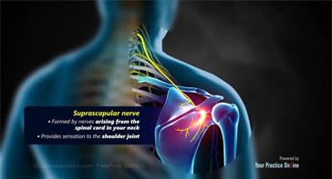 Picture of Suprascapular Nerve Block