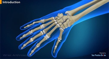 Picture of Wrist Arthroscopy