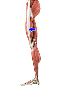 Iliotibial Band Syndrome