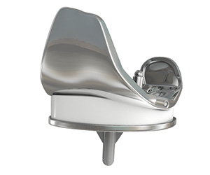 Knee Implants