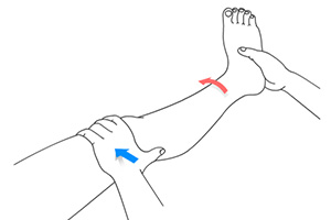 Nonoperative Treatments for ACL Injuries