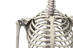 Outpatient Shoulder Replacement