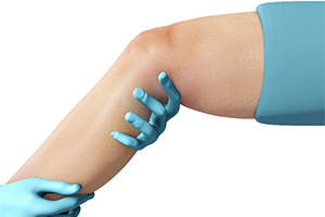 Physical Therapy for Knee