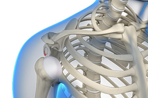 Posterior Shoulder Stabilization