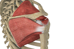 Rotator Cuff Tear