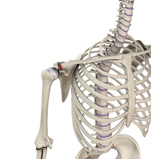 AC Joint Injury