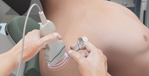 Ultrasound-guided Injection
