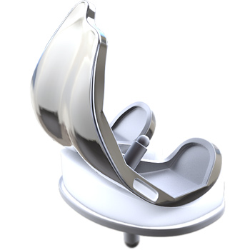 Total Knee Replacement