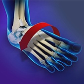 Ankle Instability Surgery