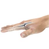 Artificial Finger Joint Replacement