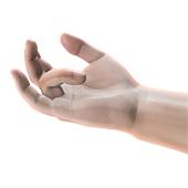 Dupuytren’s Contracture