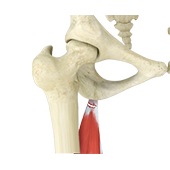 Hamstring Tendon Repair