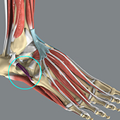 Peroneal Tendon Repair