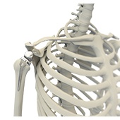 Reverse Shoulder Replacement