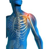 Shoulder Pain
