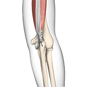 Triceps Tendon Repair