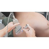 Ultrasound-Guided Shoulder Injections