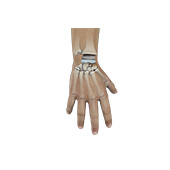 Wrist Joint Replacement