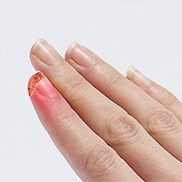 Fingertip Injury