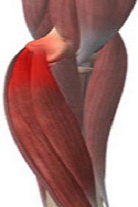Golfer's Elbow
