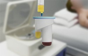 Orthobiologic Treatments for the Elbow
