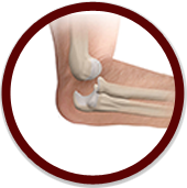 Elbow Instability