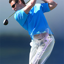 Activities After Hip Replacement