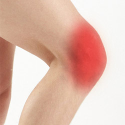 Anterior Knee Pain