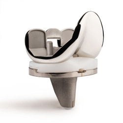 Persona Personalized Knee by Zimmer Biomet