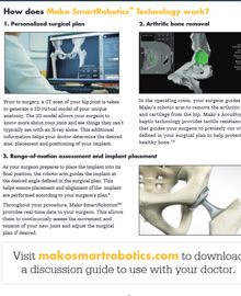 Mako SmartRobotics Total Hip Replacement