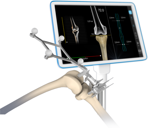 Innovative Treatments for Your Joint Health