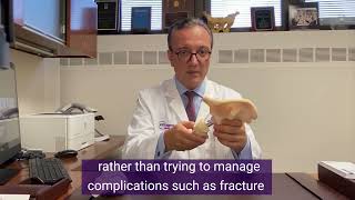 What are the types of Approach for Total Hip Replacement