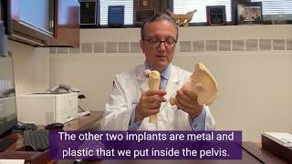 What is Total Hip Replacement