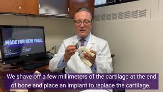 What is a Total Knee Replacement?