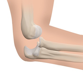 Elbow Instability