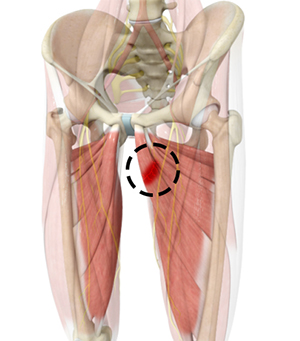 Hip Adductor Injuries 