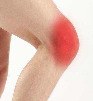 Knee Pain 