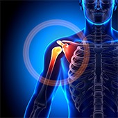 Shoulder Disorders
