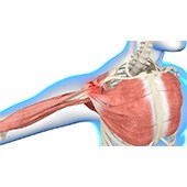 Shoulder Impingement