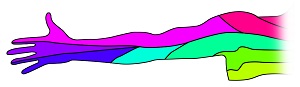 Arm Pain of Spinal Origin1